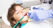 تولید سر ساکشن دندانپزشکی یک بار مصرف